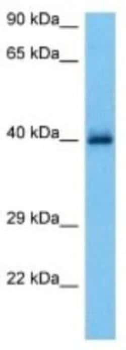 HLA B Rabbit anti-Human, Polyclonal, Novus Biologicals:Antibodies:Primary